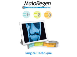MaioRegen Surgical Technique