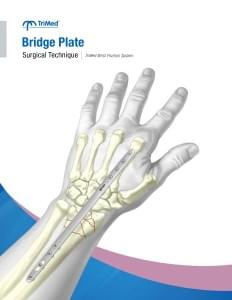 TriMed Bridge Plate - Surgical Technique